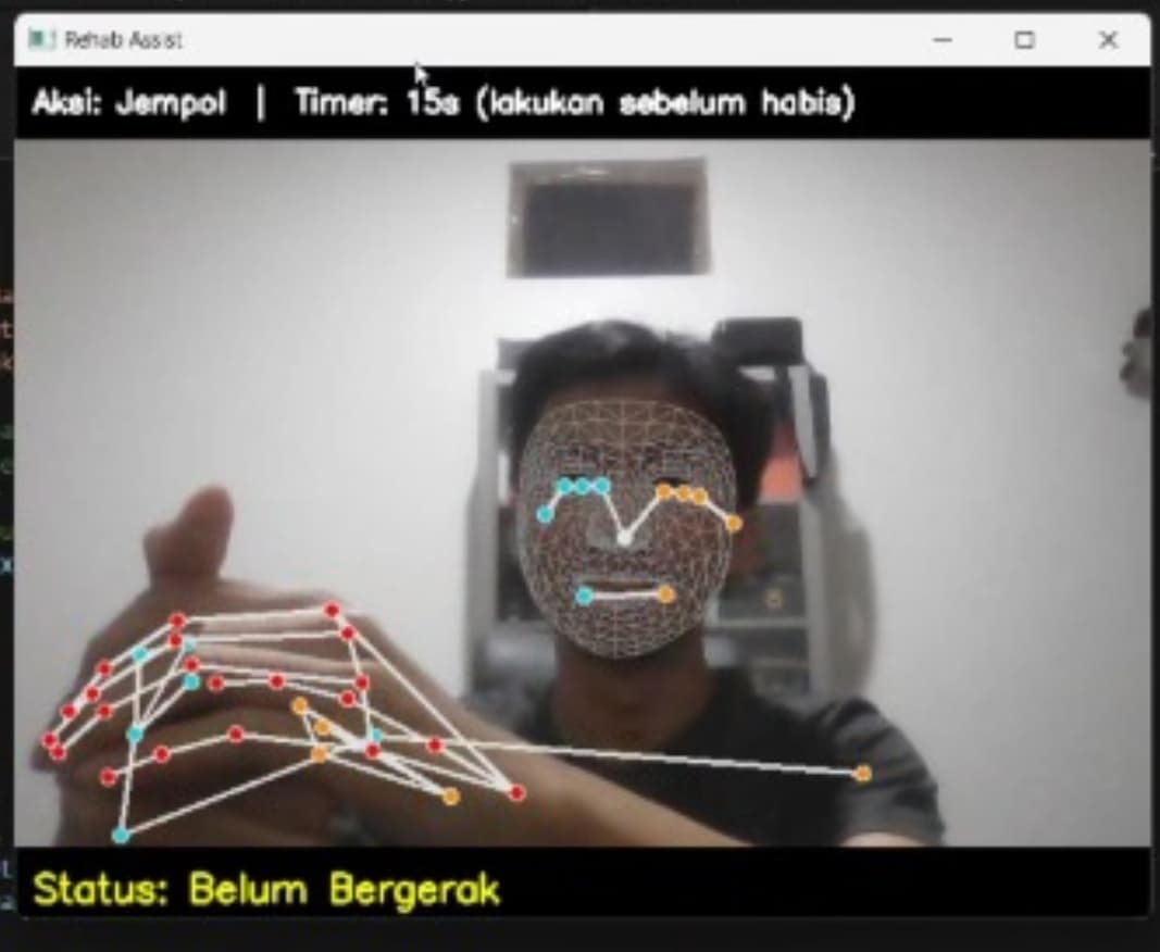 Aplikasi untuk Rehabilitasi Pasien Pasca Stroke